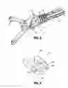 Fig. 04 - Sealing pack assembly for use with endoscopic stitching device