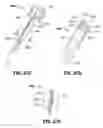 Fig. 40 - Devices, systems, and methods for providing surgical access and facilitating closure of surgical access openings