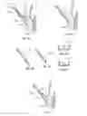 Fig. 09 - Grasping for tissue repair