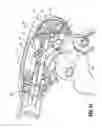 Fig. 30 - Endoscopic surgical clip applier and handle assemblies for use therewith