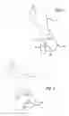 Fig. 04 - Incisionless gastric bypass system