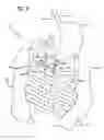 Fig. 06 - Incisionless gastric bypass system
