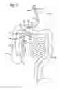 Fig. 07 - Incisionless gastric bypass system