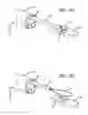 Fig. 11 - Incisionless gastric bypass system