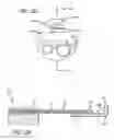 Fig. 12 - Incisionless gastric bypass system