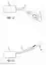 Fig. 13 - Incisionless gastric bypass system