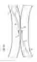 Fig. 14 - Incisionless gastric bypass system