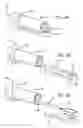 Fig. 15 - Incisionless gastric bypass system