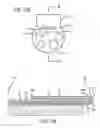 Fig. 16 - Incisionless gastric bypass system