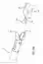 Fig. 22 - Incisionless gastric bypass system