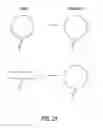 Fig. 23 - Incisionless gastric bypass system