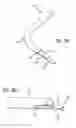 Fig. 26 - Incisionless gastric bypass system