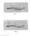 Fig. 02 - Systems and methods for endoscopic submucosal dissection using magnetically attachable clips