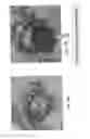 Fig. 08 - Systems and methods for endoscopic submucosal dissection using magnetically attachable clips