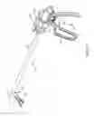 Fig. 02 - Surgical appliance