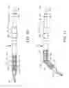 Fig. 08 - Surgical appliance