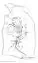 Fig. 01 - ENDOVASCULAR PULSATION BALLOON