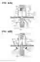 Fig. 05 - Hemostatic device