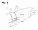 Fig. 07 - Hemostatic device