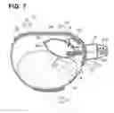 Fig. 08 - Hemostatic device