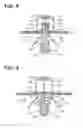 Fig. 09 - Hemostatic device