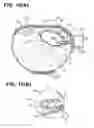 Fig. 10 - Hemostatic device