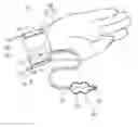 Fig. 01 - Hemostatic device