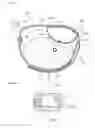Fig. 08 - Hemostatic device