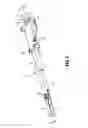 Fig. 02 - Surgical grasping instrument