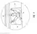 Fig. 07 - Methods and apparatuses for fluoro-less or near fluoro-less percutaneous surgery access