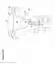 Fig. 84 - Recovery and processing of human embryos formed in vivo