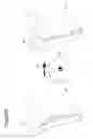 Fig. 89 - Recovery and processing of human embryos formed in vivo