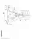 Fig. 96 - Recovery and processing of human embryos formed in vivo