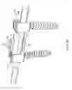Fig. 16 - Spinal rod implant extension