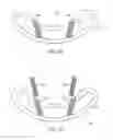 Fig. 07 - EXPANDABLE ARTICULATING INTERVERTEBRAL IMPLANT WITH LIMITED ARTICULATION
