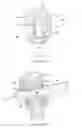 Fig. 32 - EXPANDABLE ARTICULATING INTERVERTEBRAL IMPLANT WITH LIMITED ARTICULATION