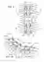 Fig. 07 - Osteotomy instrument