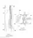 Fig. 07 - Inflatable medical devices