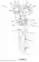 Fig. 02 - Articulated fracture fixation plate assembly and method of use
