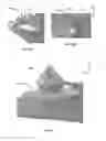 Fig. 17 - Flexible construct for femoral reconstruction