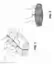 Fig. 02 - SURGICAL SUTURE ASSEMBLY