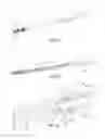 Fig. 08 - Systems and methods for promoting sacroiliac joint fusion