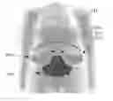Fig. 01 - Non-Invasive, Uniform and Non-Uniform RF Methods and Systems Related Applications