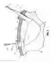 Fig. 06 - Specimen retrieval device