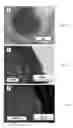 Fig. 04 - Methods and compositions for tissue adhesives