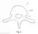 Fig. 04 - Determining an optimal placement of a pedicle screw