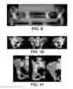 Fig. 10 - Surgical navigation of the hip using fluoroscopy and tracking sensors
