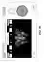Fig. 32 - Surgical navigation of the hip using fluoroscopy and tracking sensors
