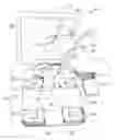 Fig. 01 - SURGICAL TRACKING SYSTEM FOR TRACKING AND VISUALIZING THE RELATIVE POSITIONING OF TWO OR MORE SURGICAL COMPONENTS