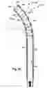 Fig. 05 - Surgical device tip with deflectable joint